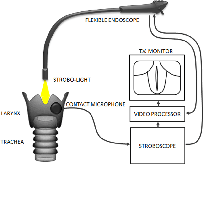 video stroboscopy