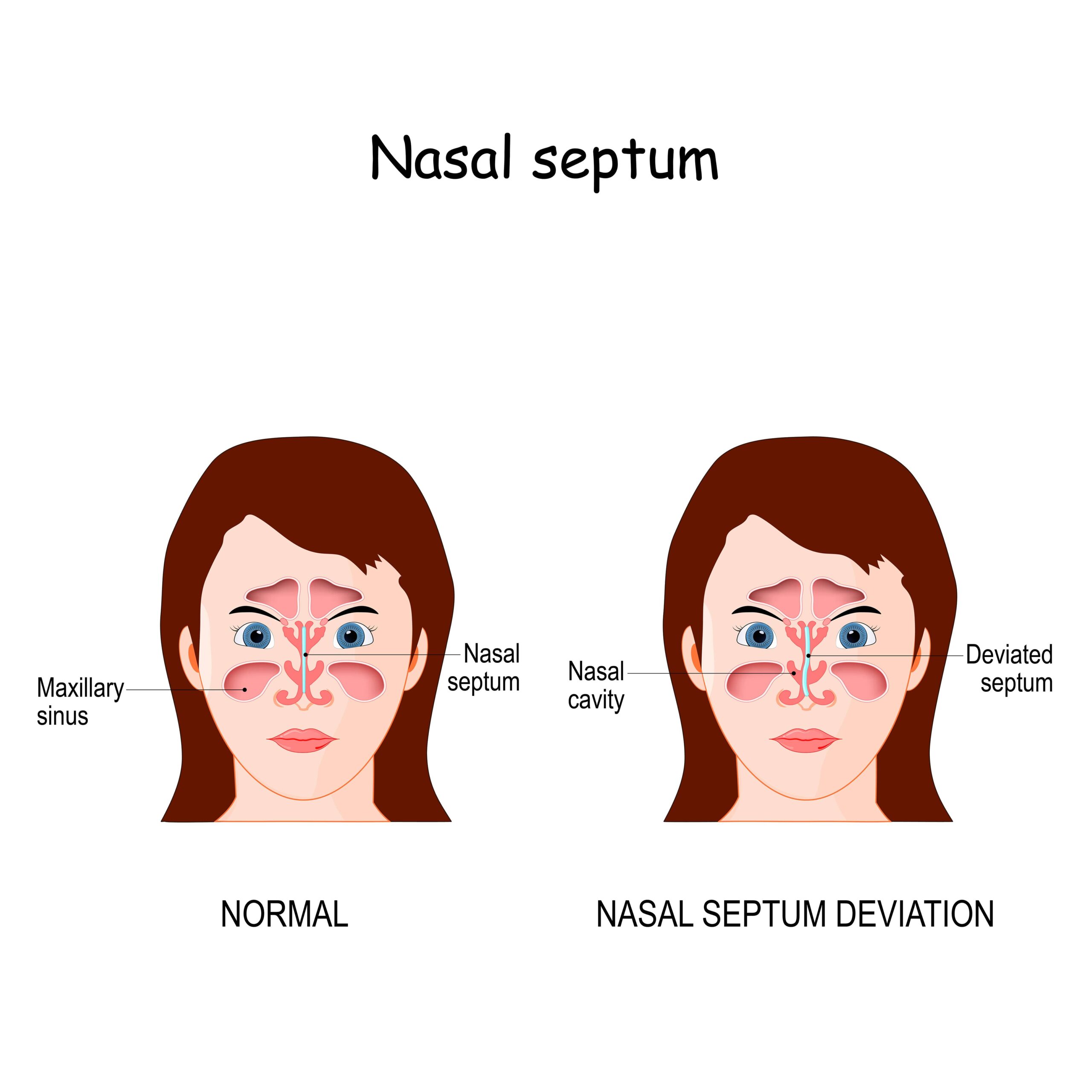 nasal septum